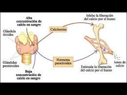 Hipercalcemia